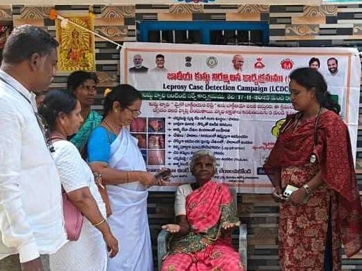 ‘లెప్రసీ కేసు డిటెక్షన్ ‘ క్యాంపెయిన్ ప్రారంభం