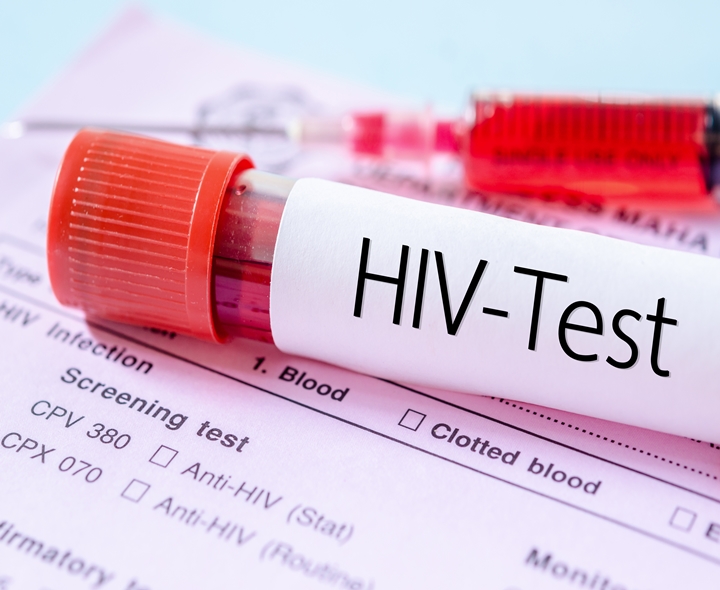 ప్రతి నెలా 100 కొత్త HIV కేసులు