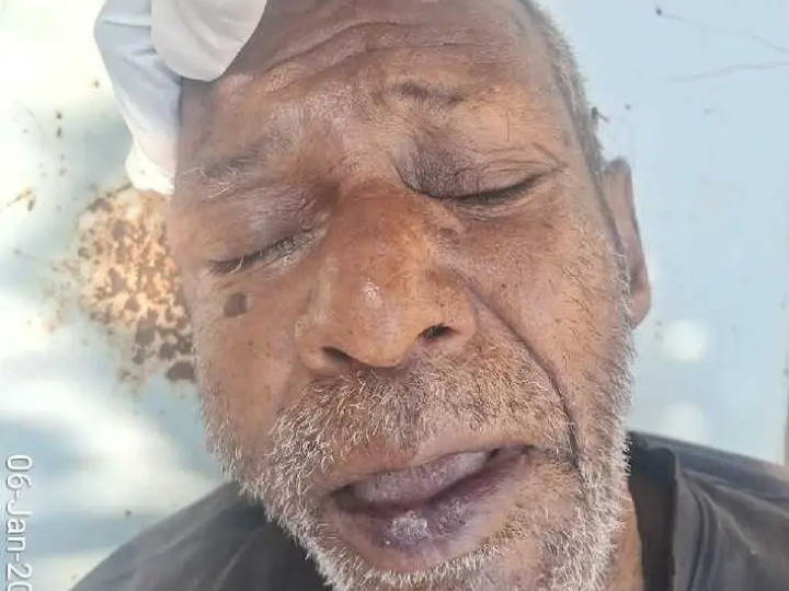 గాంధీ ఆస్పత్రి ఆవరణలో గుర్తుతెలియని వ్యక్తి మృతి