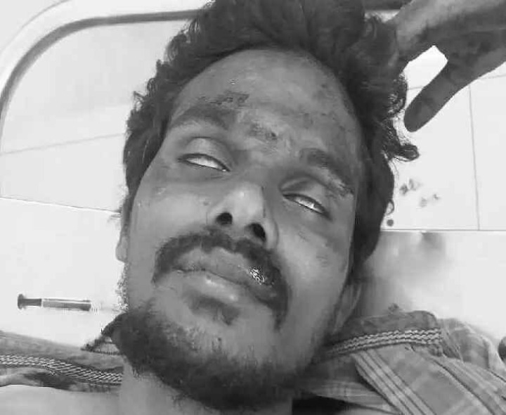 రోడ్డు ప్రమాదం.. యువకుడి పరిస్థితి విషమం