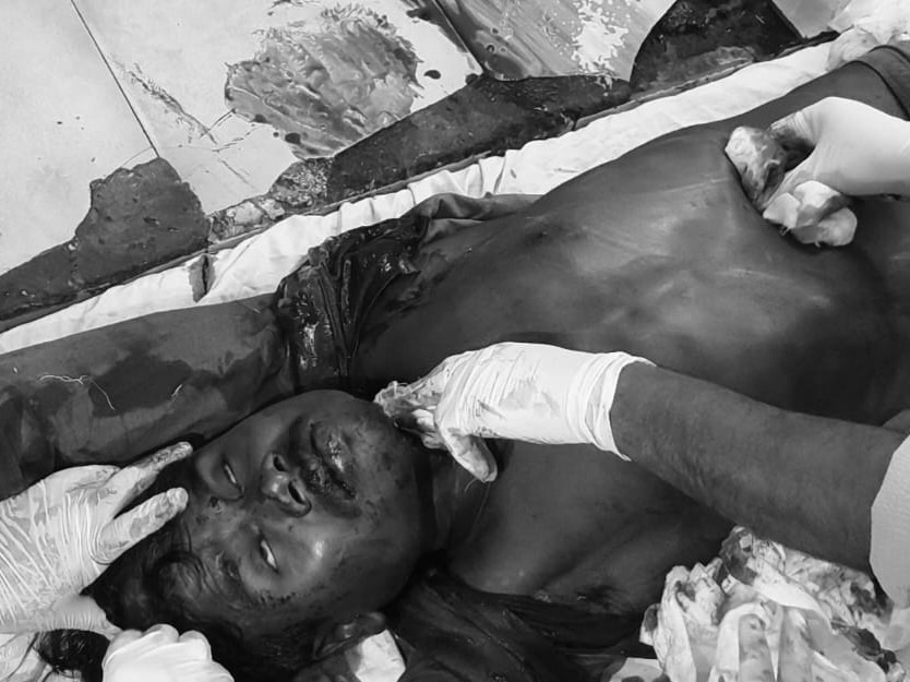 ఆసుపత్రిలో సైకో దాడి