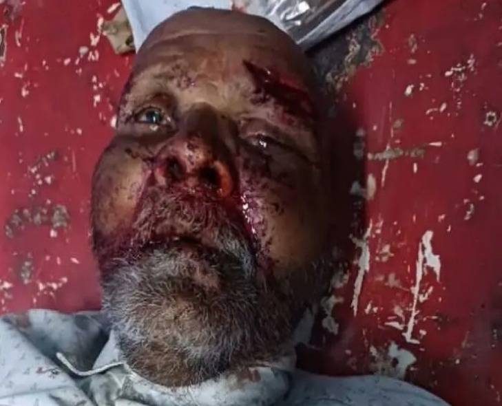 చిట్టాపూర్ ఎక్స్ రోడ్డు ప్రమాదం.. వ్యక్తి మృతి