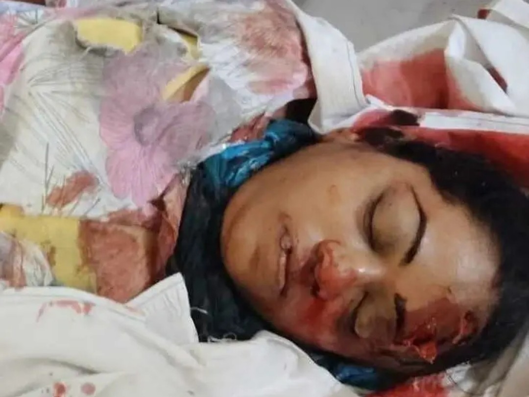 తిరుపతిలో రోడ్డు ప్రమాదం.. మహిళ మృతి