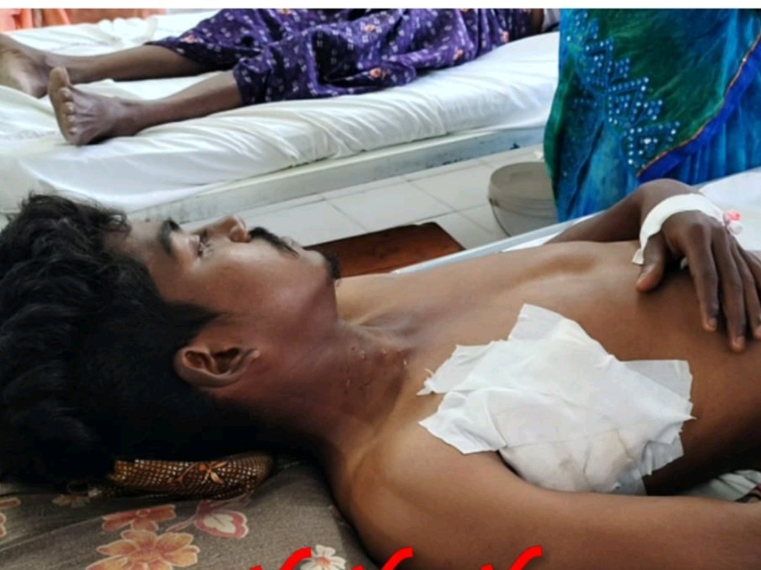 ట్యూబ్ లైట్‌తో స్నేహితుడిని పొడిచిన యువకుడు