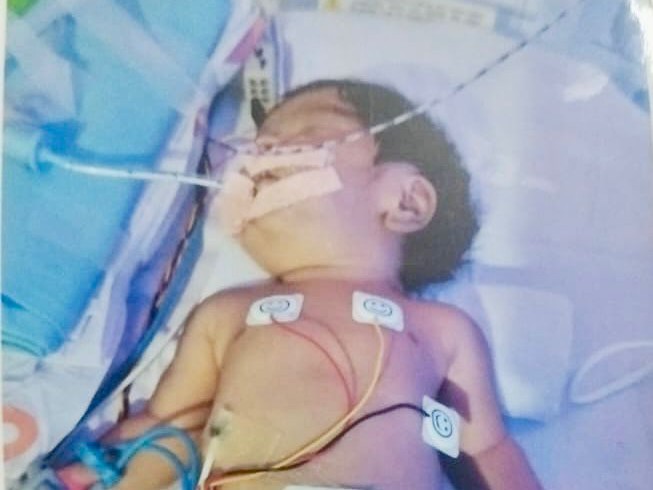 పసిబిడ్డ ప్రాణాలను కాపాడిన ఎమ్మెల్యే మద్దిపాటి