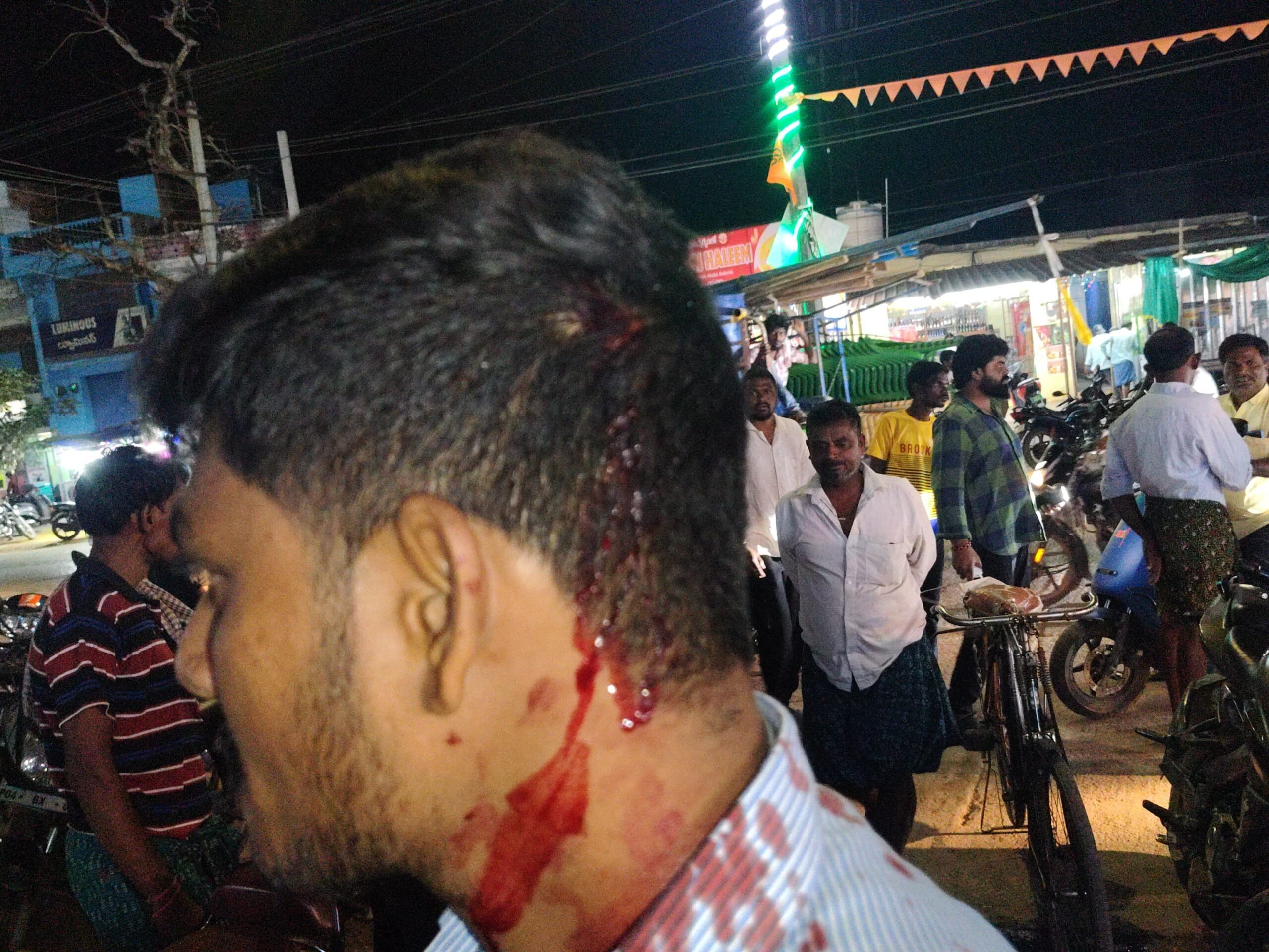 కెనరా బ్యాంకు సెక్యూరిటీ గార్డ్‌పై దాడి