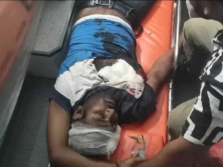 ఘోర రోడ్డు ప్రమాదం.. వ్యక్తికి తీవ్ర గాయాలు