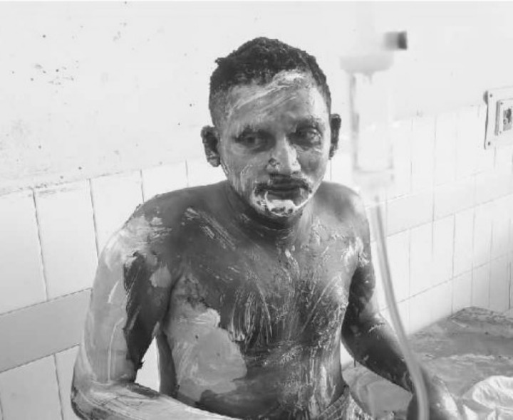 పెట్రోల్ దాడిలో గాయపడిన వ్యక్తి మృతి