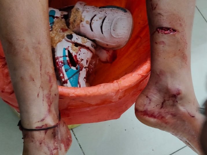 అన్నమయ్య: పాత రాయచోటిలో పిచ్చి కుక్క సైరవిహారం