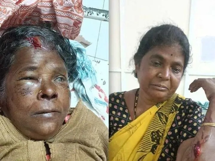 భార్యభర్తల గొడవ.. కత్తితో దాడి