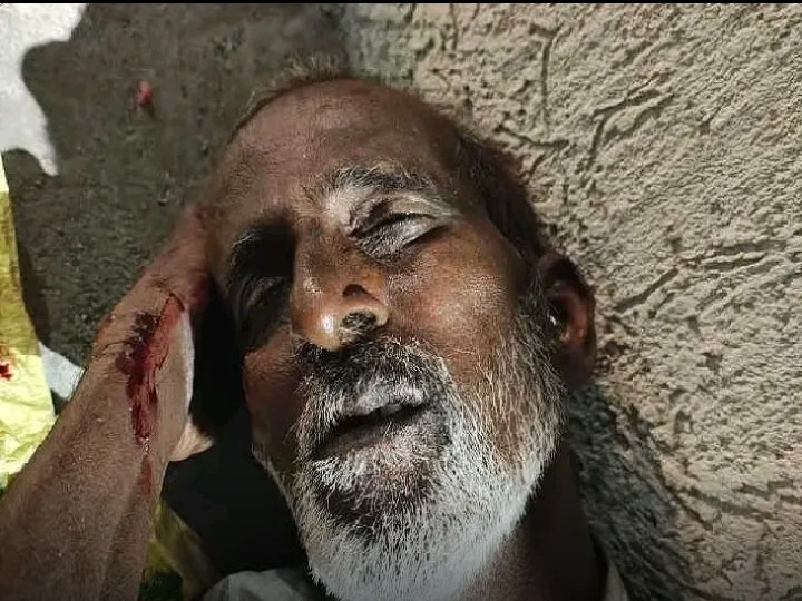 గాంధీ ఆసుపత్రి సమీపంలో మృతదేహం లభ్యం