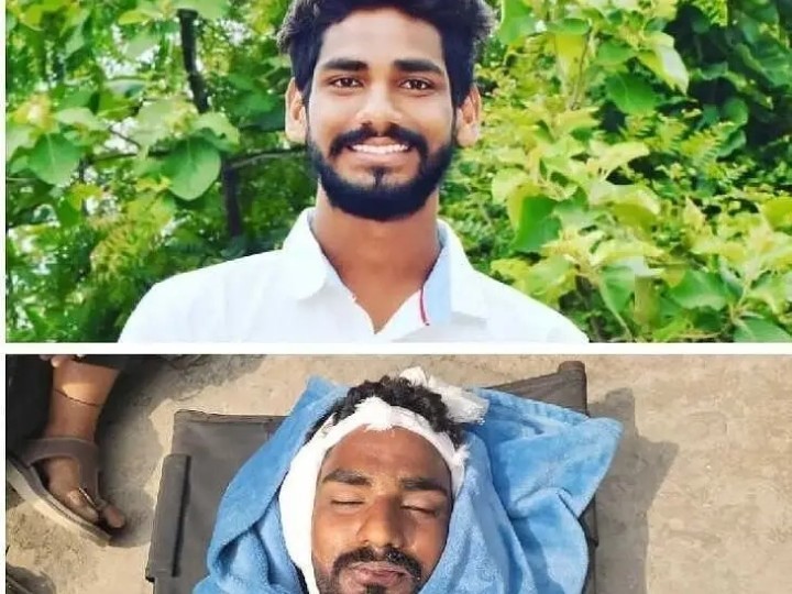 చెవి నొప్పికి ఆపరేషన్.. యువకుడి మృతి