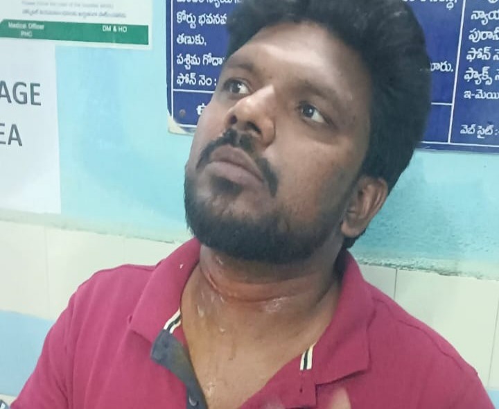 మెడకు తగిలిన కేబుల్ వైర్లు.. తప్పిన ప్రాణాపాయం