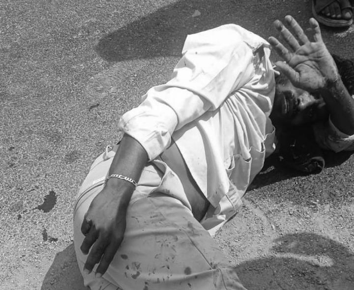 రోడ్డు ప్రమాదంలో వ్యక్తికి తీవ్ర గాయాలు