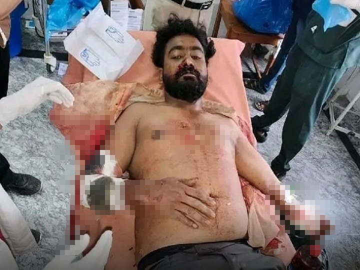 ప్రేమ వివాహం.. యువకుడిపై యువతి సోదరుడి దాడి