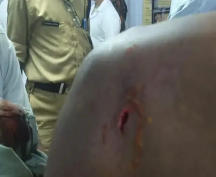 తిరుమలనగర్‌లో కత్తిపోట్ల కలకలం