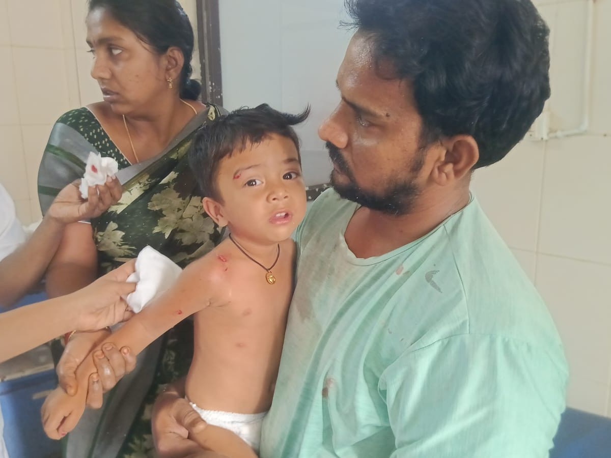 బాలుడి పై కుక్క దాడి..!