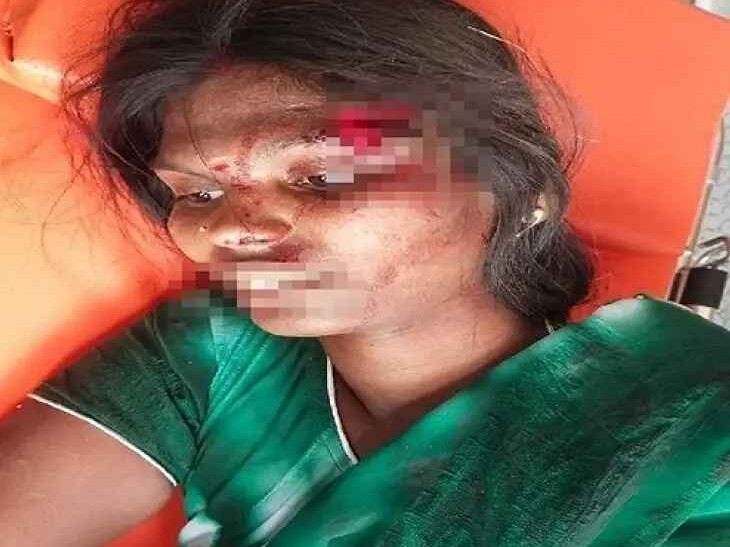 రోడ్డు ప్రమాదం.. ముగ్గురికి తీవ్రగాయాలు