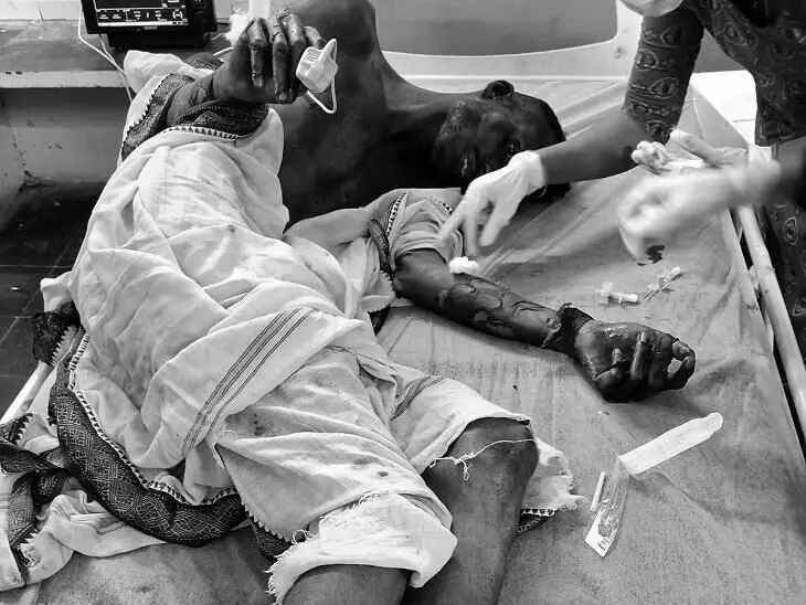 మృత్యువుతో పోరాడి ఓడిన దిలీప్