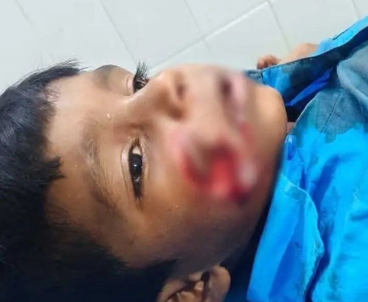 బాలుడిపై వీధి కుక్కల దాడి