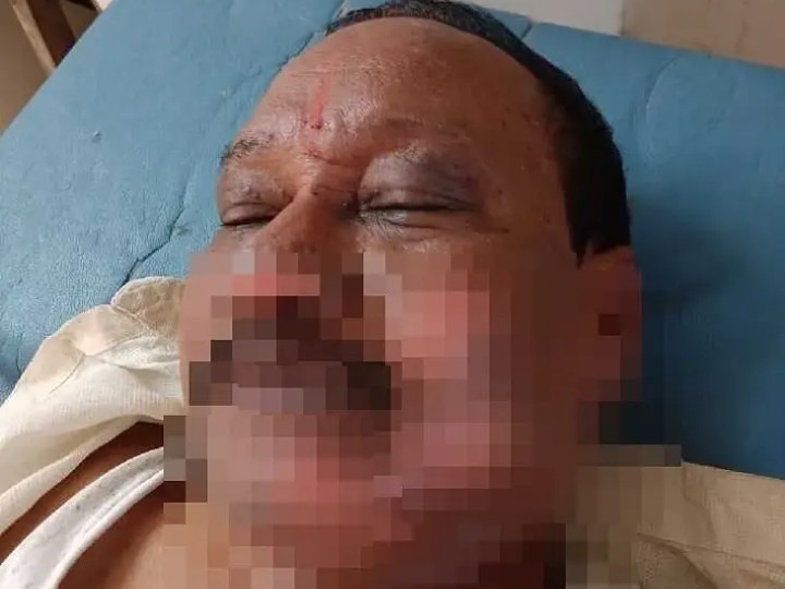 గ్యాస్ లీక్.. పరిస్థితి విషమం