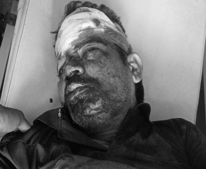 ద్విచక్రవాహనం అదుపుతప్పి వ్యక్తికి తీవ్రగాయాలు