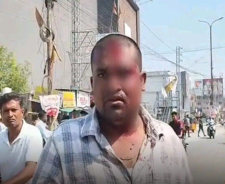 టీ ఆలస్యమైందని తల పగలకొట్టారు