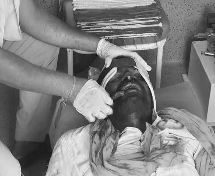 రోడ్డు ప్రమాదంలో నాలుక కోల్పోయిన వ్యక్తి