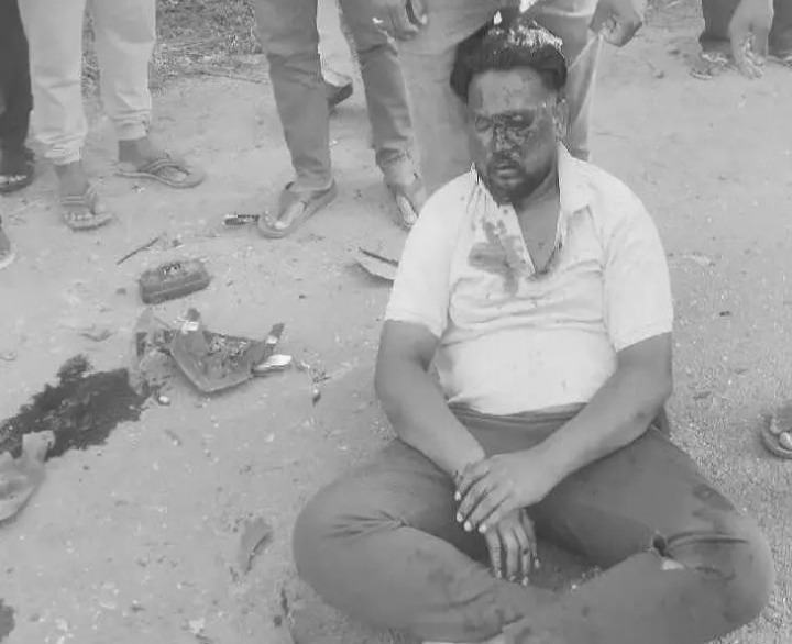 కారు ఢీకొని యువకునికి తీవ్ర గాయాలు