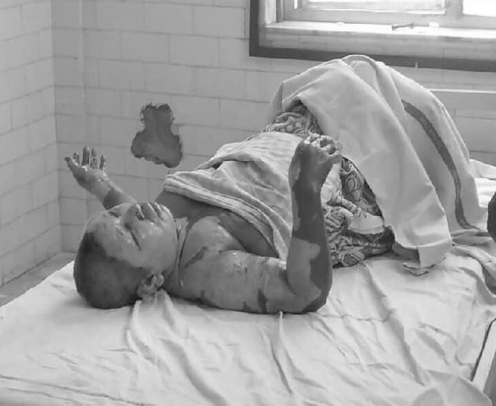 భార్యకు నిప్పంటించి భర్త ఆత్మహత్య