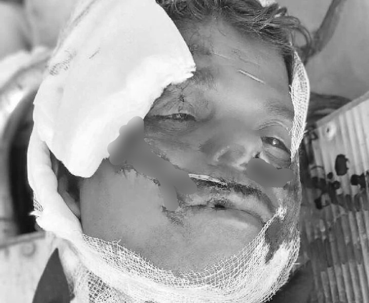 చెట్టుకు ఢీకొన్న బైక్.. ఒకరు మృతి