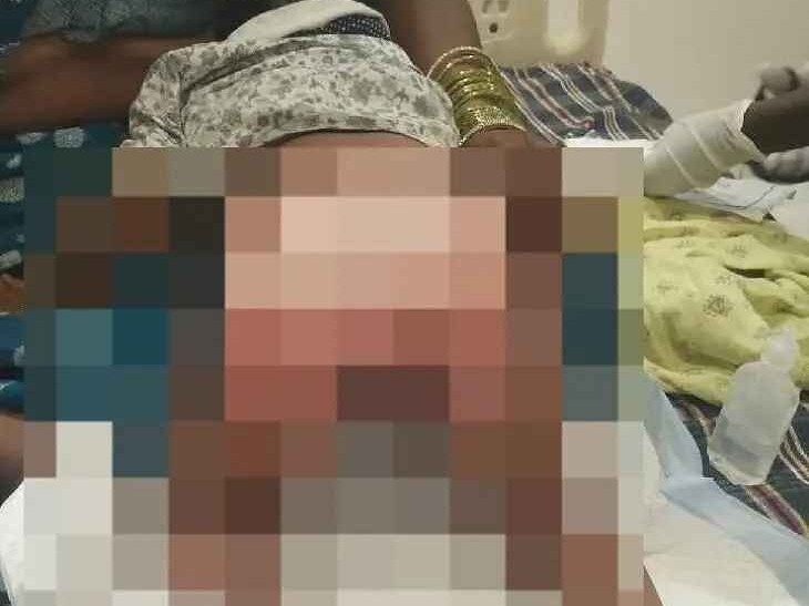 అంగన్వాడీలో చిన్నారి గాయాలు