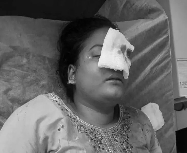 బైక్ ఢీకొని తండ్రీకూతురికి గాయాలు