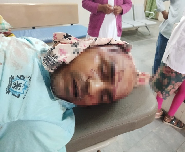 రోడ్డు ప్రమాదంలో ఒకరు మృతి మరొకరికి గాయాలు