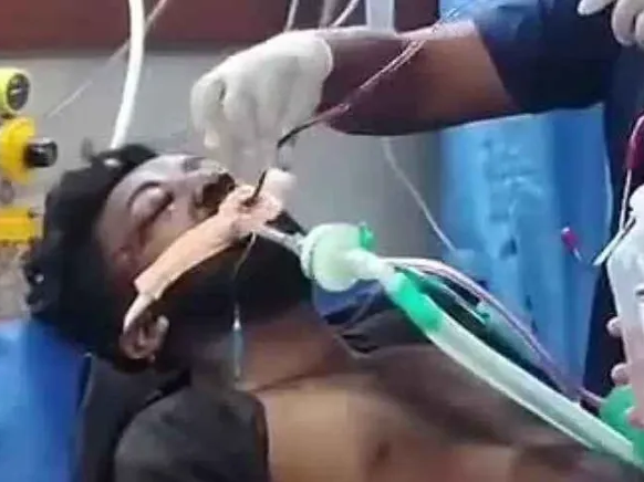 బైకు అదుపుతప్పి యువకుడికి గాయాలు..!