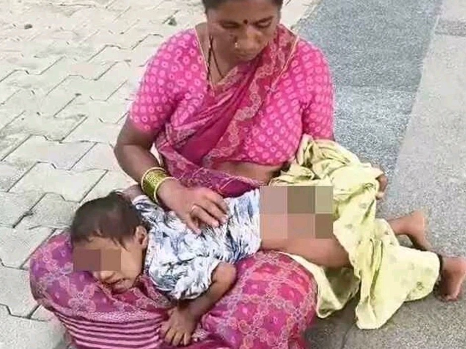 వేడి నీటిలో పడి చిన్నారికి గాయాలు