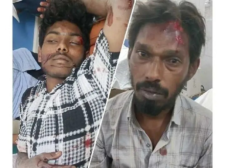 కారు, బైక్ ఢీకొని ఇద్దరికీ తీవ్ర గాయాలు
