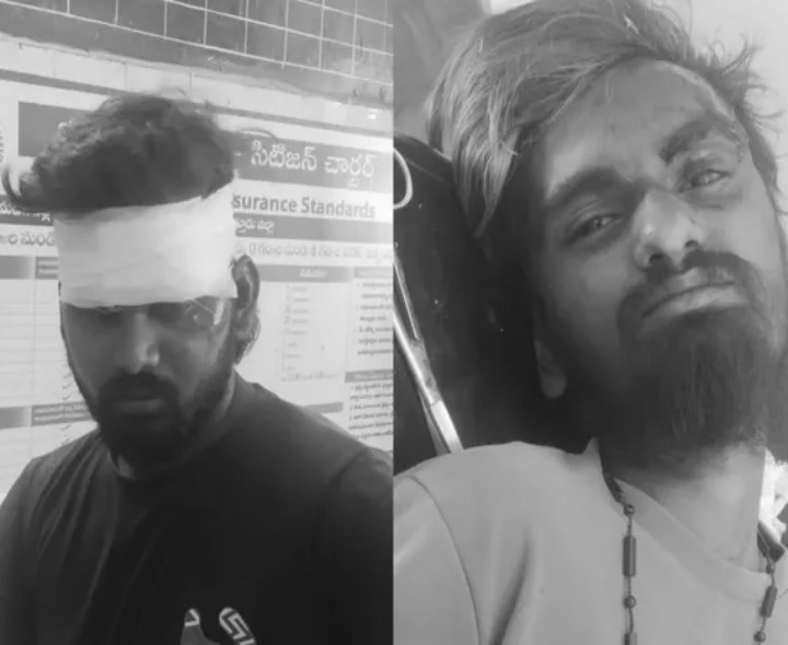 రోడ్డు ప్రమాదంలో అన్నదమ్ములకు తీవ్ర గాయాలు