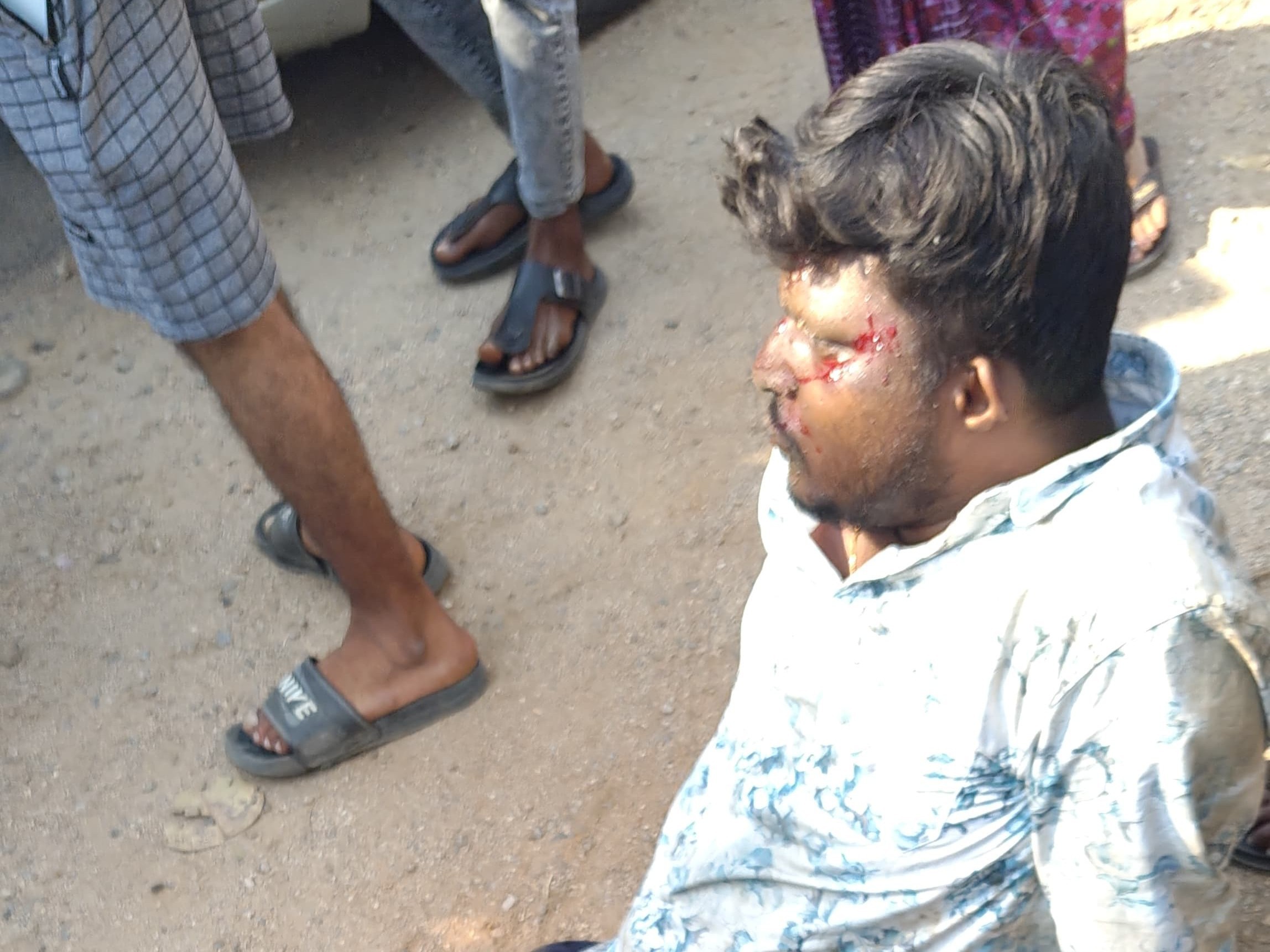 బైక్‌ను ఢీకొన్న కారు.. తల్లీ కొడుకులకు తీవ్ర గాయాలు