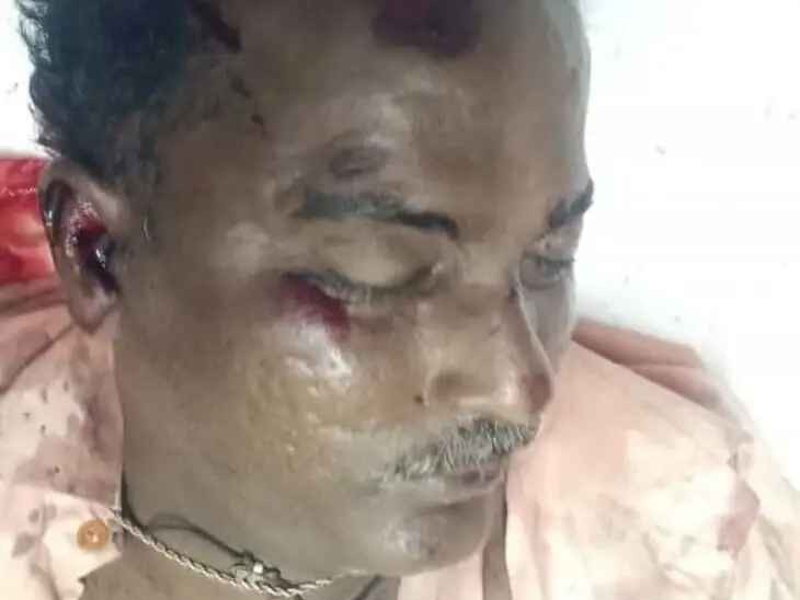 రోడ్డు ప్రమాదంలో భర్త మృతి.. భార్యకు గాయాలు