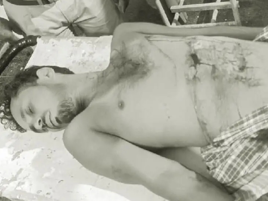 బీర్ బాటిల్‌తో కడుపులో పొడుచుకున్న కపిల్