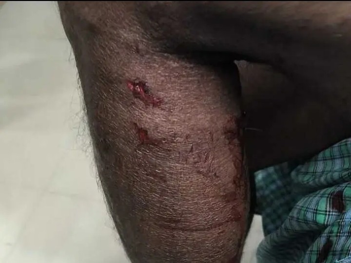 పిచ్చికుక్కల దాడిలో ఐదుగురికి గాయాలు