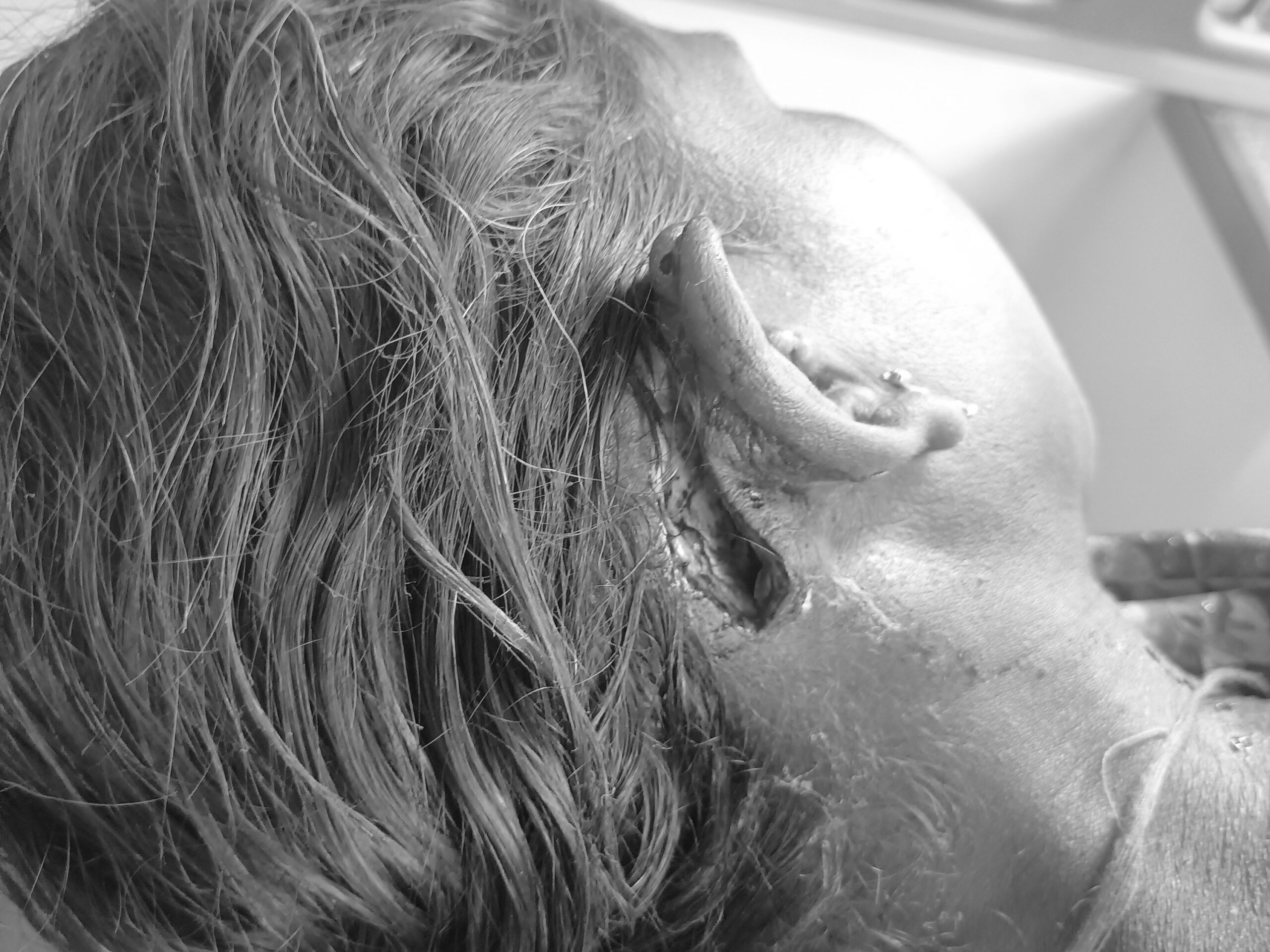 ఉపాధి పనుల్లో ప్రమాదం.. మహిళకు తీవ్ర గాయాలు