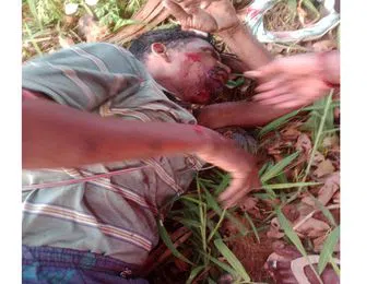 తాటి చెట్టు పైనుంచి పడి గీత కార్మికుడికి గాయాలు