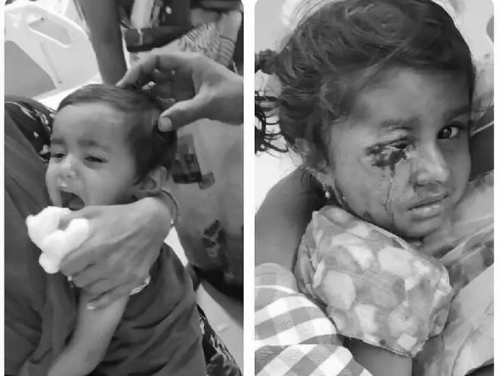 చింతామణిపల్లిలో చిన్నారులపై కుక్కల దాడి