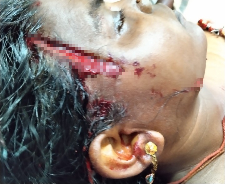 మామండూరులో మహిళపై హత్యాయత్నం