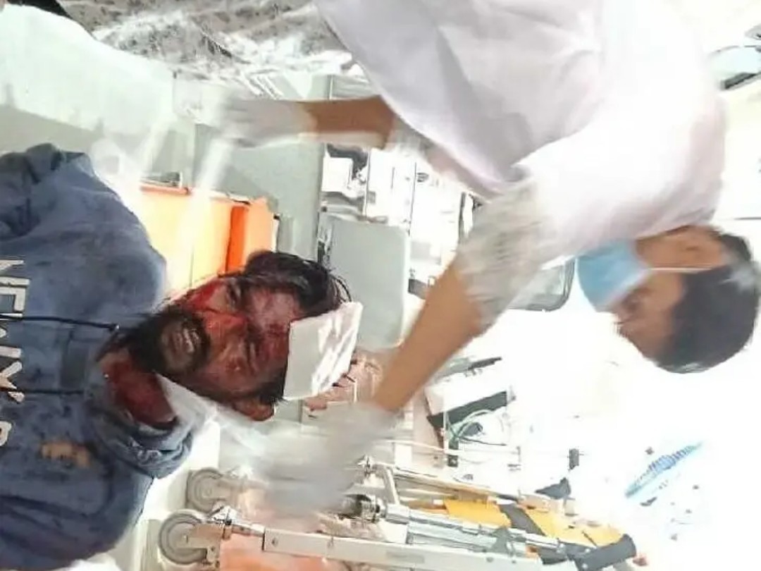 బైక్ ప్రమాదం.. యువకుడికి తీవ్ర గాయాలు.!