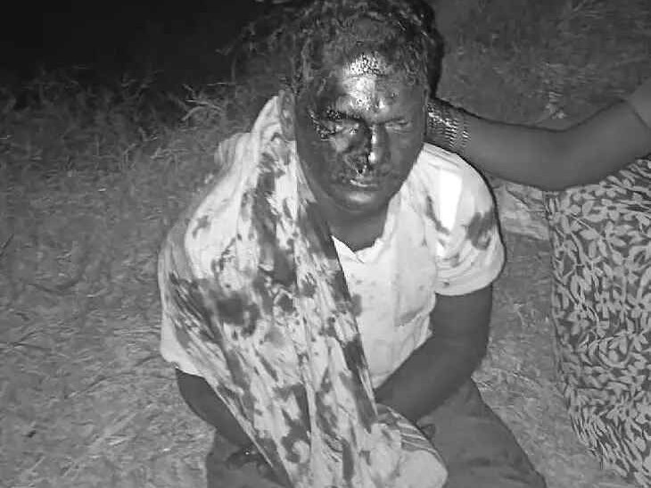 రోడ్డుపై వడ్లు.. ప్రమాదంలో వ్యక్తికి గాయాలు