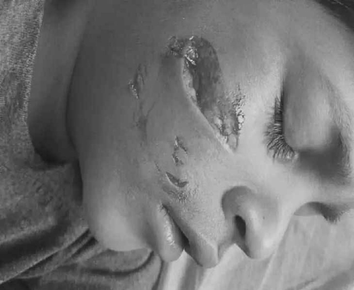 బాలుడిపై విచక్షణారహితంగా వీధి కుక్కల దాడి