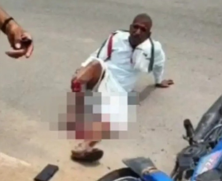 లారీ ఢీకొని వ్యక్తికి తీవ్ర గాయాలు